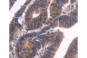 Immunohistochemistry (IHC) image for anti-Nuclear Factor of Activated T-Cells, Cytoplasmic, Calcineurin-Dependent 3 (NFATC3) antibody (ABIN2824670)