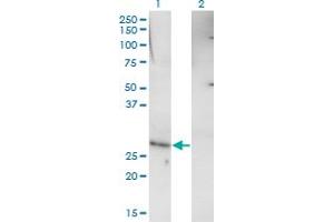 Western Blot analysis of RHOXF1 expression in transfected 293T cell line by RHOXF1 monoclonal antibody (M01), clone 4D12. (RHOXF1 antibody  (AA 1-110))