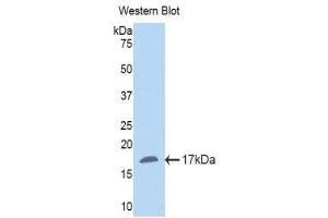 Western Blotting (WB) image for anti-Nicotinamide N-Methyltransferase (NNMT) (AA 127-249) antibody (ABIN1860014) (NNMT antibody  (AA 127-249))