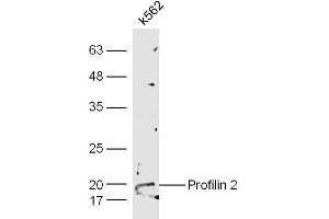 Human K562 cell lysates probed with Anti-Profilin 2 Polyclonal Antibody  at 1:5000 90min in 37˚C. (PFN2 antibody  (AA 51-140))
