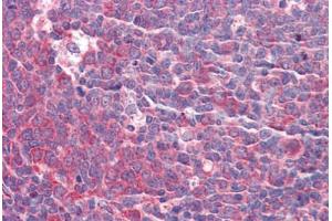 Human Tonsil: Formalin-Fixed, Paraffin-Embedded (FFPE) (GOLM1 antibody  (AA 38-87))