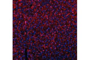 IF analysis of MRC1 using anti-MRC1 antibody (ABIN7600593).