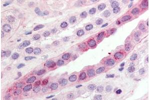 Human Kidney (formalin-fixed, paraffin-embedded) stained with GPR15 antibody ABIN213351 at 10 ug/ml followed by biotinylated goat anti-rabbit IgG secondary antibody ABIN481713, alkaline phosphatase-streptavidin and chromogen. (GPR15 antibody  (C-Term))