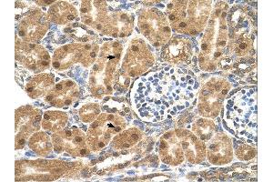 Immunohistochemistry (IHC) image for anti-Prolyl 4-Hydroxylase, beta Polypeptide (P4HB) (N-Term) antibody (ABIN633962)