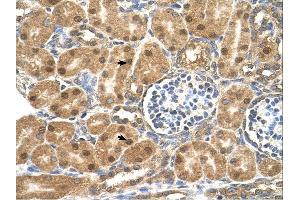 P4HB antibody was used for immunohistochemistry at a concentration of 4-8 ug/ml. (P4HB antibody  (N-Term))