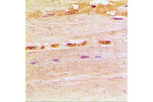Immunohistochemical analysis of UDG staining in human muscle formalin fixed paraffin embedded tissue section. (UDG (Center) antibody)