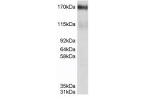Image no. 2 for anti-ATP-Binding Cassette, Sub-Family C (CFTR/MRP), Member 4 (ABCC4) (C-Term) antibody (ABIN374484) (ABCC4 antibody  (C-Term))