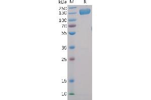 Human CD22, hFc-His Tag on SDS-PAGE under reducing condition.