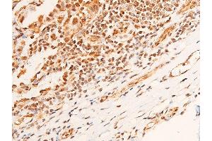 Immunohistochemistry (IHC) image for anti-Checkpoint Kinase 1 (CHEK1) (pSer296) antibody (ABIN6256251)