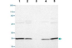 Western blot analysis of Lane 1: Human cell line RT-4, Lane 2: Human cell line U-251MG sp, Lane 3: Human plasma (IgG/HSA depleted), Lane 4: Human liver tissue, Lane 5: Human tonsil tissue with PSMD10 polyclonal antibody  at 1:250-1:500 dilution.