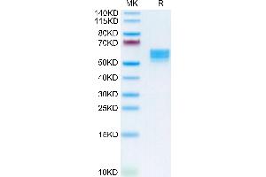 Human CD83 on Tris-Bis PAGE under reduced condition. (CD83 Protein (CD83) (AA 20-143) (Fc Tag))