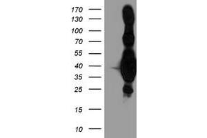 Western Blotting (WB) image for anti-Heme Oxygenase (Decycling) 2 (HMOX2) antibody (ABIN1498685) (HMOX2 antibody)