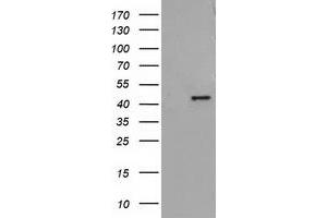 HEK293T cells were transfected with the pCMV6-ENTRY control (Left lane) or pCMV6-ENTRY ADH1B (Right lane) cDNA for 48 hrs and lysed. (ADH1B antibody)