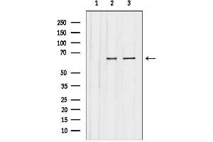 anti-Chromatin Assembly Factor 1, Subunit A (p150) (CHAF1A) (N-Term) antibody