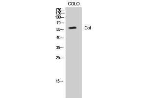 Western Blotting (WB) image for anti-Carnitine O-Octanoyltransferase (CROT) (Ser253) antibody (ABIN3174521) (CROT antibody  (Ser253))