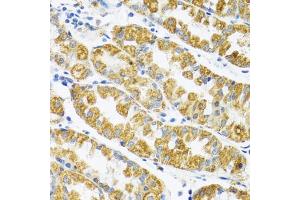 Immunohistochemistry (IHC) image for anti-Polymerase (DNA Directed), gamma 2, Accessory Subunit (POLG2) (AA 216-485) antibody (ABIN6145894)