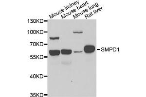 Western blot analysis of extracts of various cell lines, using SMPD1 antibody (ABIN5974079) at 1/1000 dilution. (SMPD1 antibody)