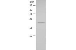 Western Blotting (WB) image for Myosin Light Chain 7, Regulatory (MYL7) (AA 1-175) protein (His tag) (ABIN7286910) (MYL7 Protein (AA 1-175) (His tag))