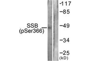 Western blot analysis of extracts from 293 cells, using SSB (Phospho-Ser366) Antibody. (SSB antibody  (pSer366))