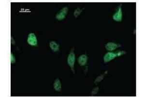 Immunostaining analysis in HeLa cells. (LHX2 antibody)