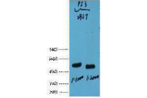 Western Blotting (WB) image for anti-Tumor Protein P53 (TP53) antibody (ABIN3181122) (p53 antibody)