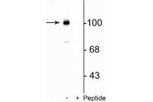 Western blot of mouse brain lysate showing the specific immunolabeling of the ~102 kDa mGluR7 protein phosphorylated at Ser862 in the first lane (-). (GRM7 antibody  (pSer862))