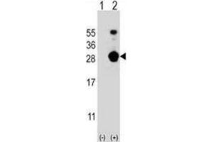 Western blot analysis of FKBP7 (arrow) using FKBP7 / FKBP23 Antibody (C-term); 293 cell lysates (2 ug/lane) either nontransfected (Lane 1) or transiently transfected (Lane 2) with the FKBP7 gene. (FKBP7 antibody  (C-Term))