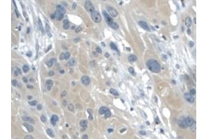 Detection of GAL2 in Human Esophagus Tissue using Monoclonal Antibody to Galectin 2 (GAL2) (Galectin 2 antibody  (AA 1-132))
