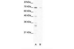 Image no. 1 for anti-Zinc Finger Protein 37A (ZNF37A) (AA 381-430) antibody (ABIN203208)