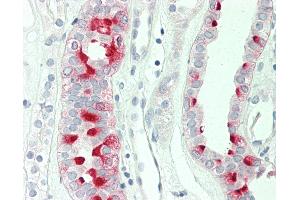 Human Kidney: Formalin-Fixed, Paraffin-Embedded (FFPE) (ATP6V1F antibody)