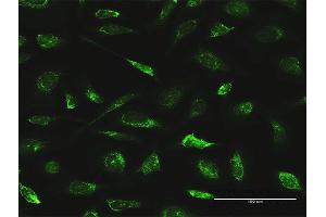 Immunofluorescence (IF) image for anti-Apoptosis-Inducing Factor, Mitochondrion-Associated, 1 (AIFM1) (AA 1-613) antibody (ABIN522589)