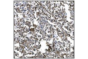 IHC analysis of CD39/ENTPD1 using anti-CD39/ENTPD1 antibody (ABIN7602461). (CD39 antibody  (AA 79-411))
