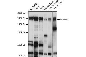 Western blot analysis of extracts of various cell lines, using SUPT6H antibody (ABIN7270645) at 1:1000 dilution. (Spt6 antibody  (AA 1500-1726))