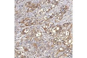 IHC analysis of Mitochondrial Dicarboxylate Carrier/SLC25A10 using anti-Mitochondrial Dicarboxylate Carrier/SLC25A10 antibody (ABIN7601497).