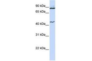 Image no. 1 for anti-Minichromosome Maintenance Deficient 9 (MCM9) (N-Term) antibody (ABIN6742708) (MCM9 antibody  (N-Term))
