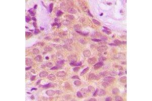 Immunohistochemistry (IHC) image for anti-Protein Phosphatase 2A Activator, Regulatory Subunit 4 (PPP2R4) antibody (ABIN7308210) (PPP2R4 antibody)