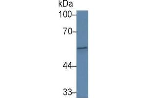 Rabbit Capture antibody from the kit in WB with Positive Control: Sample Human serum. (CFP ELISA Kit)