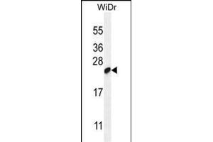 LOC147646 Antibody (C-term) (ABIN655852 and ABIN2850489) western blot analysis in WiDr cell line lysates (35 μg/lane). (C19orf84 antibody  (C-Term))