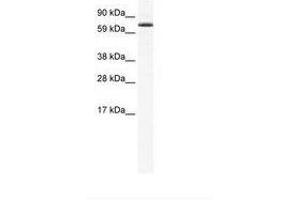 Image no. 1 for anti-Forkhead Box O6 (Foxo6) (AA 176-225) antibody (ABIN202762) (Foxo6 antibody  (AA 176-225))