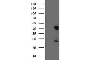 HEK293T cells were transfected with the pCMV6-ENTRY control (Left lane) or pCMV6-ENTRY ENDOG (Right lane) cDNA for 48 hrs and lysed. (Endonuclease G antibody)