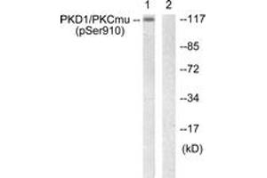 Western blot analysis of extracts from A431 cells, using PKD1/PKC mu (Phospho-Ser910) Antibody. (PKC mu antibody  (pSer910))
