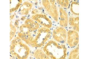 Immunohistochemistry of paraffin-embedded Human kidney using PDE4DIP Polyclonal Antibody at dilution of 1:100 (40x lens). (PDE4DIP antibody)
