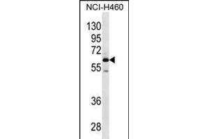 MEPE Antibody (N-term) (ABIN656329 and ABIN2845628) western blot analysis in NCI- cell line lysates (35 μg/lane).