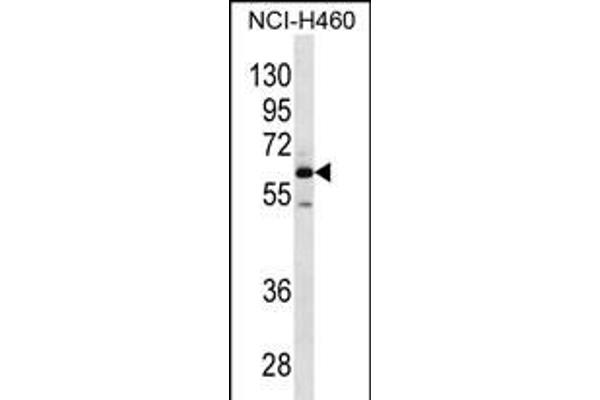 MEPE anticorps  (N-Term)