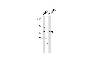 Western blot analysis of lysates from Hela cell line and mouse lung tissue lysate(from left to right), using Mouse Epha4 Antibody (Center) (ABIN6243788 and ABIN6577535). (EPH Receptor A4 antibody  (AA 309-342))