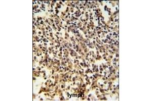 RNASEH2B Antibody (Center) (ABIN650970 and ABIN2840016) IHC analysis in formalin fixed and paraffin embedded human lymph tissue followed by peroxidase conjugation of the secondary antibody and DAB staining. (RNASEH2B antibody  (AA 130-157))