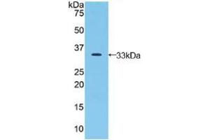 Western blot analysis of recombinant Human JAG2. (JAG2 antibody  (AA 714-981))