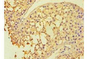 Immunohistochemistry of paraffin-embedded human testis tissue using ABIN7154834 at dilution of 1:100 (HAUS3 antibody  (AA 384-603))