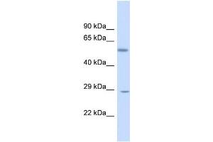 Host:  Rabbit  Target Name:  KLF9  Sample Type:  Fetal Liver lysates  Antibody Dilution:  1. (KLF9 antibody  (N-Term))