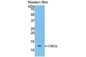 Western blot analysis of the recombinant protein. (SLIT3 antibody  (AA 62-119))